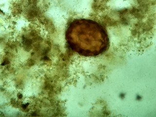 Huevo de Sacarosa lumbricoides 400x Fresco