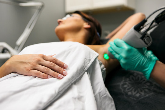 Spa: Female Patient Undergoing Laser Hair Removal Treatment