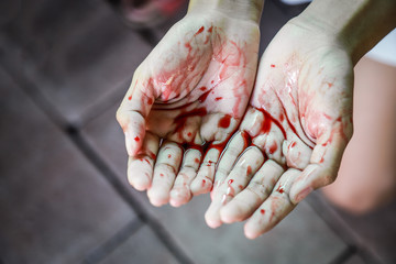 bloody blood on hand 