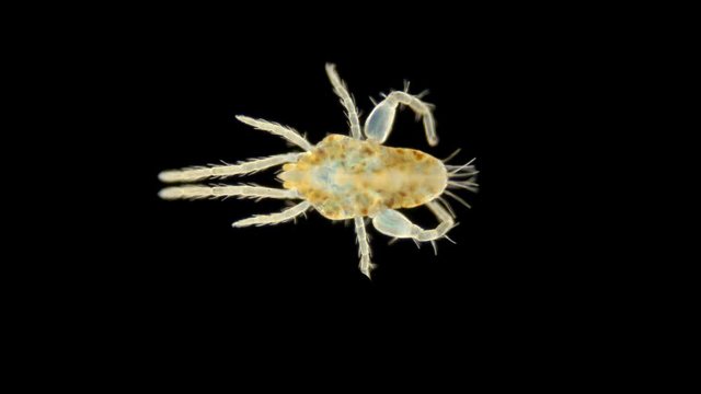 tick under the microscope, family Eupodoidea, order Trombidiformes, the species is phytophage and predatory, characterized by thick hind legs. The video shows the movement and work of internal organs
