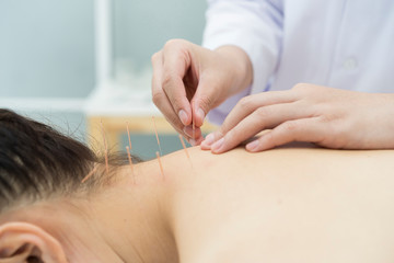 doctor or Acupuncturist inserting a needle into Asian female neck or back. patient having traditional Chinese treatment using acupuncture to restore an energy flow through specific points on the skin - obrazy, fototapety, plakaty