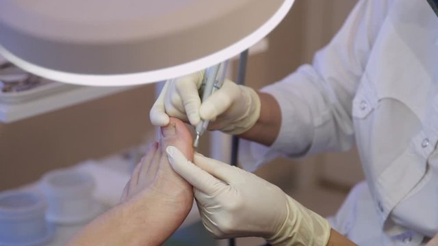 Podologist treats the patient's big toe.Podology.Hardware pedicure