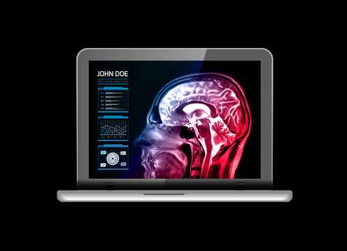 Notebook monitor with medical MRI and other real-time analyzes. Medicine of the future. illustration on black