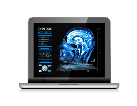Notebook monitor with medical MRI and other real-time analyzes. Medicine of the future. illustration on white