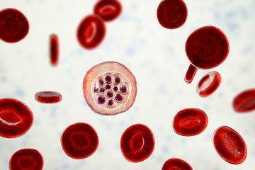 Fototapeta premium Red blood cells infected with malaria parasite Plasmodium vivax, schizont stage, 3D illustration