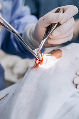 The surgeon's holing the instrument in abdomen of patient. The surgeon's doing laparoscopic surgery in the operating room. Minimally invasive surgery. selective focus