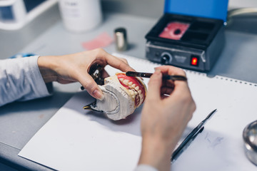 Dental prosthesis, female hands working on the denture. Selective focus.
