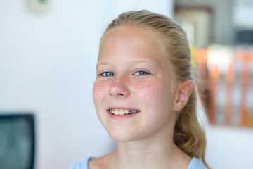 A teenage girl with a removable orthodontic appliance. Smiling with a bracket on her teeth. The...