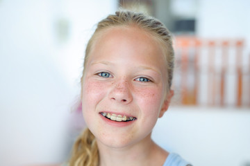 A teenage girl with a removable orthodontic appliance. Smiling with a bracket on her teeth. The...
