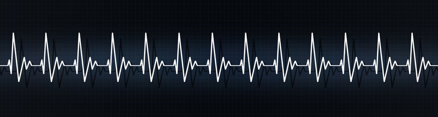 rapid heart pulse beats on ecg
