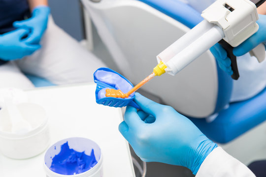 Dentist prepares material for a mold of teeth. Close-up of a dentist in blue gloves