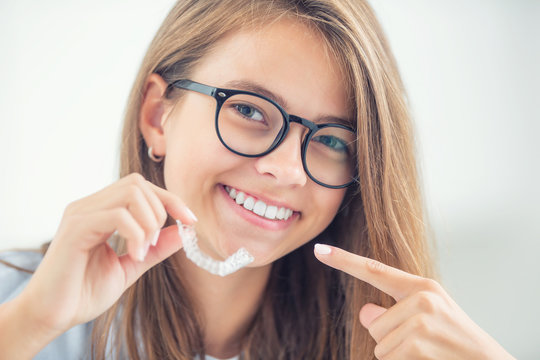 Dental invisible braces or silicone trainer in the hands of a young smiling girl. Orthodontic concept - Invisalign