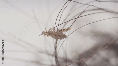 Human Head Lice On The Human Hair Stock Footage And Royalty Free