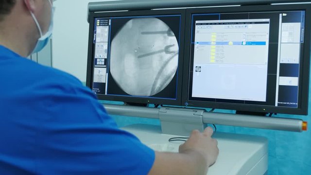 doctor examines an x-ray on a monitor