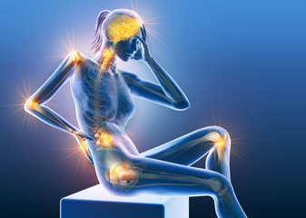 Rheumatoid arthritis, osteoarthritis, painful joints of a woman, medically 3D illustration - obrazy, fototapety, plakaty