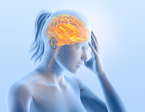 Headache, Migraine Of A Woman With Brain An Nerves, Medically 3D Illustration On Light Blue Background