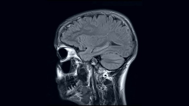 Medical computed tomography of human head, RMI scan against black background.
