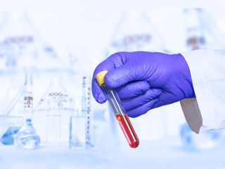 Doctor holding a test tube with blood in his hand, blood test for diseases like cancer. Concept of...