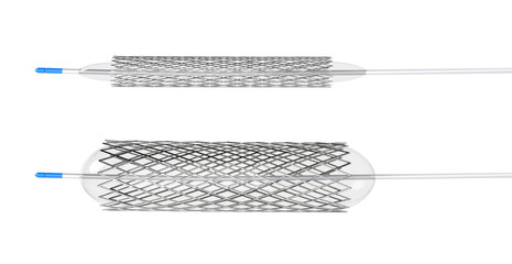 Stent for balloon angioplasty