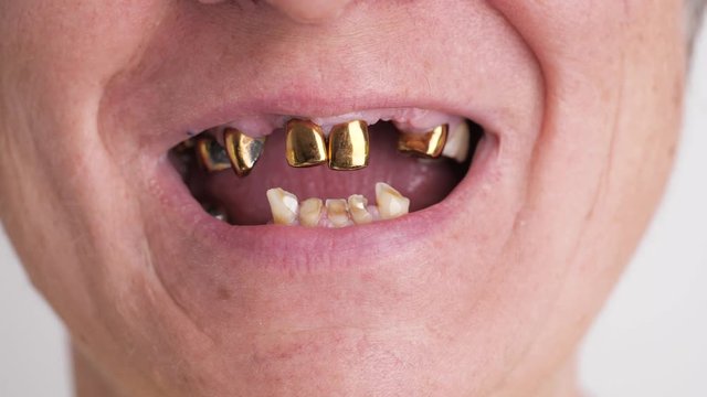 Toothless Mouth. Toothless smile of an elderly woman