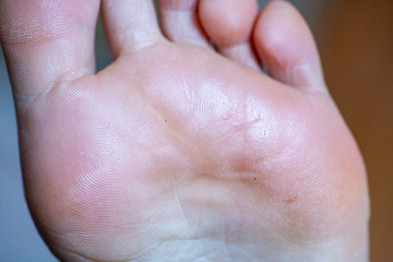 young girl's toes are healthy and beautiful.