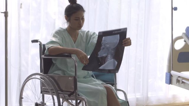Serious patient looking at x-ray image of her brain injury surgery. Bad health result and medical malpractice concept.