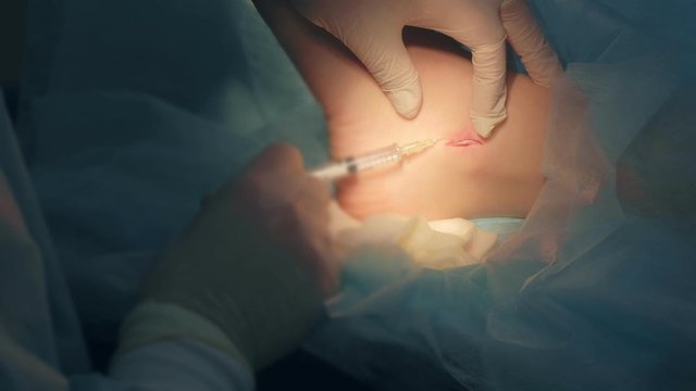 Surgeon man inputting drug for local anesthesia during surgery to sew up wound on leg, hands closeup. Infiltration anesthesia to removal ankle joint hygroma operation in hospital. One day surgery.