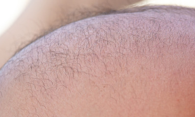 Hair on the chest and abdomen in a man