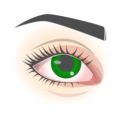 Swollen eye concept. Symptom of the eye disease, allergy