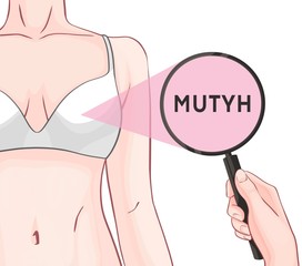Variants in the MUTYH gene are associated with an increased risk of developing breast cancer