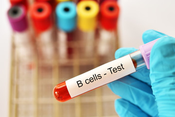 Obraz premium Blood sample tube for B lymphocytes or B cells test