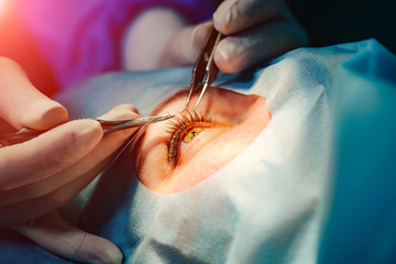Ophthalmic Clinic, surgery. Laser correction for vision.