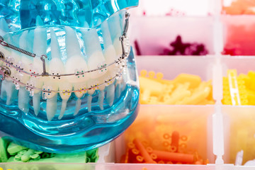 Close up  orthodontic model  - demonstration teeth model of varities of orthodontic bracket or brace