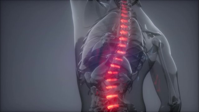 backache in backbone. science anatomy scan of human spine bones glowing