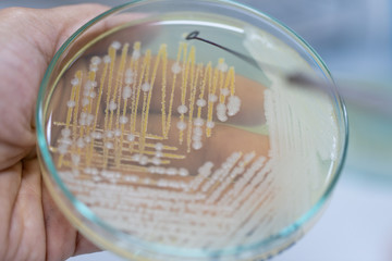 Colony Characteristics of Yeast in petri dish for education.