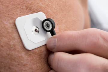 Fototapeta premium close up of placing an electrocardiography ECG EKG electrode pad for a heart monitor