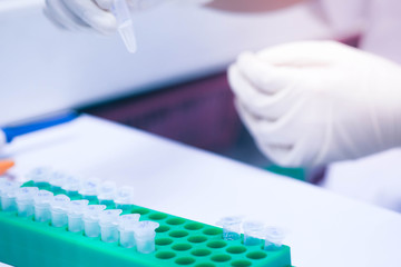 eppendorf tube on pastic rack in laboratory/ Scientific laboratory technician working with blood and biomaterial via sampler metering and other laboratory equipment in the laboratory