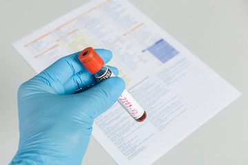 Doctor's hand with medical glove holding a labeled blood probe in front of request form