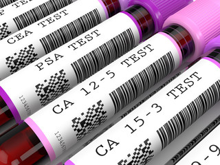 3d render of  blood samples with tumor markers test