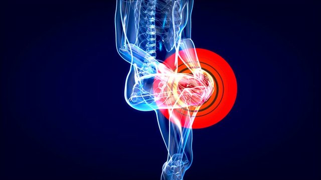 Knee sprain or ache leading to pain motion design