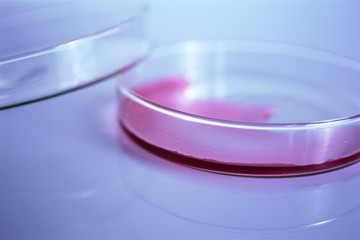 petri dish