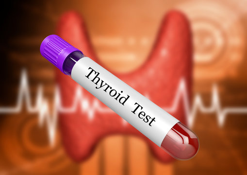 Blood sample in test tube for hormonal examination of thyroid gland in laboratory
