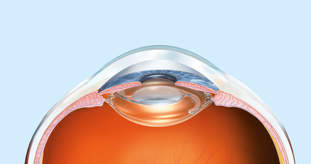 Human eye with artificial lens, lmedically 3D illustration - obrazy, fototapety, plakaty