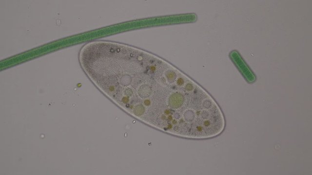 Frontonia sp. is a genus of free-living unicellular ciliate protists under the microscope.