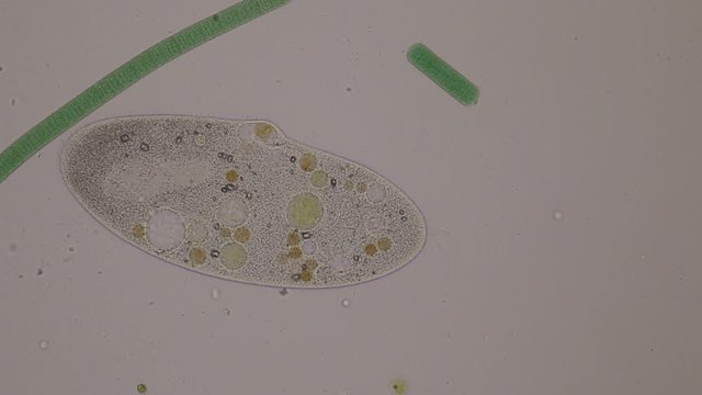 Frontonia sp. is a genus of free-living unicellular ciliate protists under the microscope.