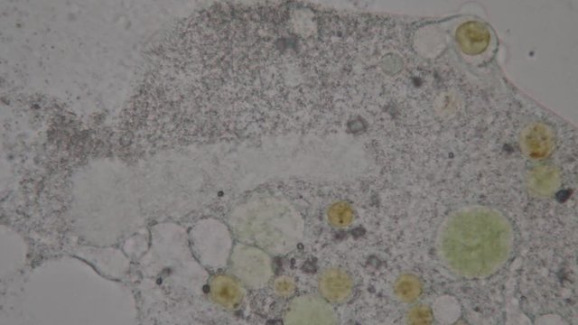 Frontonia sp. is a genus of free-living unicellular ciliate protists under the microscope.