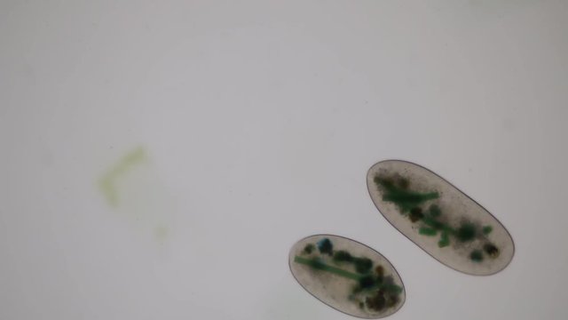 Frontonia sp. is a genus of free-living unicellular ciliate protists under the microscope.