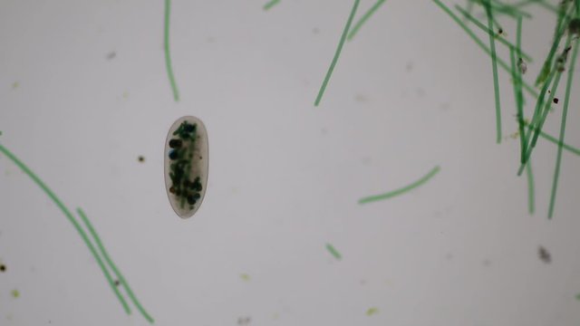 Frontonia sp. is a genus of free-living unicellular ciliate protists under the microscope.