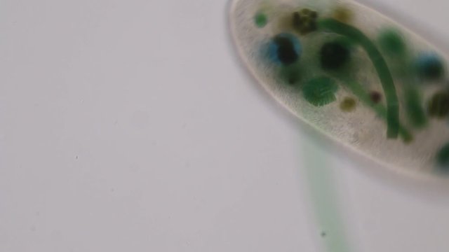 Frontonia sp. is a genus of free-living unicellular ciliate protists under the microscope.