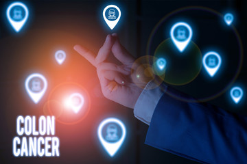 Text sign showing Colon Cancer. Business photo showcasing the development of cancer cells from the...